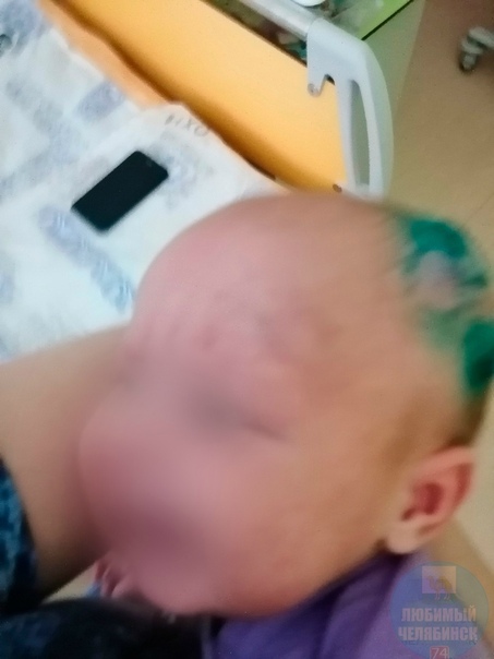 В челябинской больнице мать издевалась над двухмесячным ребёнком В Челябинской областной детской